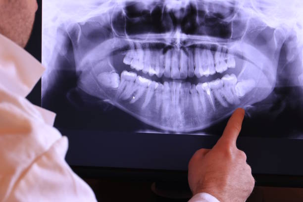 Best Emergency Dentist for Knocked-Out Tooth in Spirit Lake, ID
